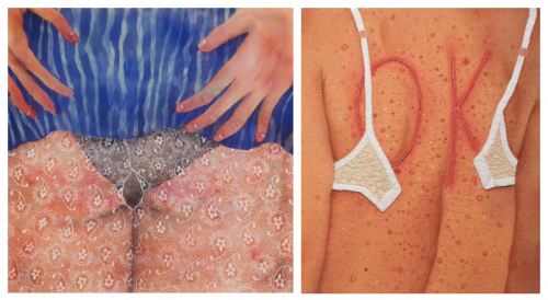 Paintings by Katarina Reising in Artsy, "Body Issues: The Pleasures of Painting Skin", by Alina Cohen